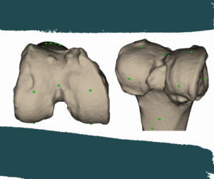 3d model of your knee (1)